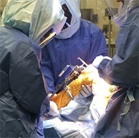 Computer Assisted Surgery